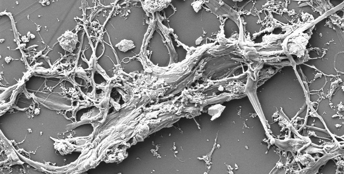 Typische Form eines Cellulosefibrids (REM), koaguliert aus ionischer Flüssigkeit