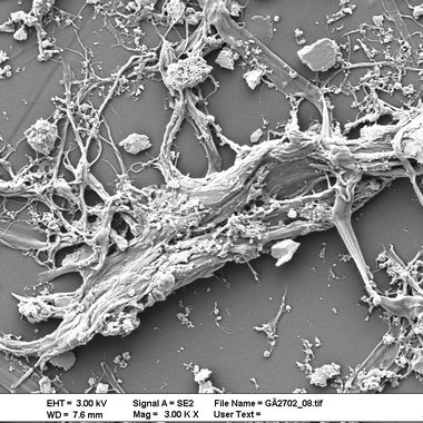 Typische Form eines Cellulosefibrids (REM), koaguliert aus ionischer Flüssigkeit